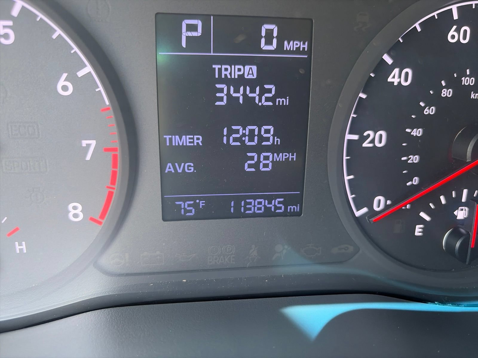 Used 2018 Hyundai Accent SE FWD image 16