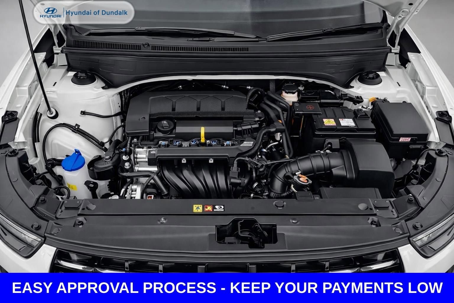 Used 2026 Hyundai Venue SEL image 15