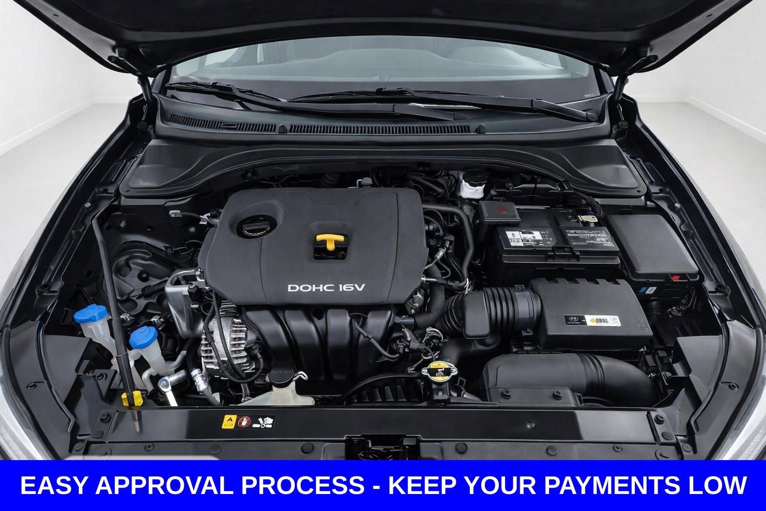 Used 2018 Hyundai Elantra SEL FWD image 18