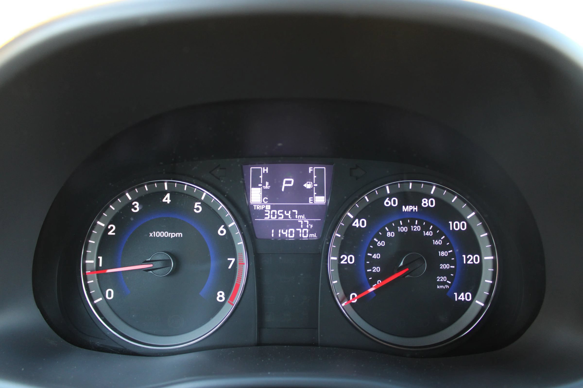 Used 2017 Hyundai Accent SE FWD image 35