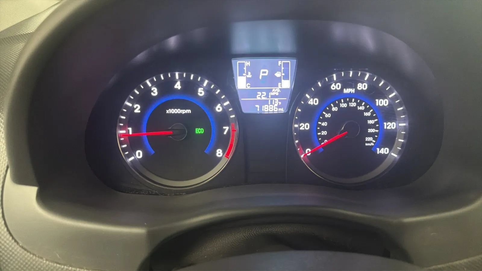 Used 2017 Hyundai Accent SE FWD image 11