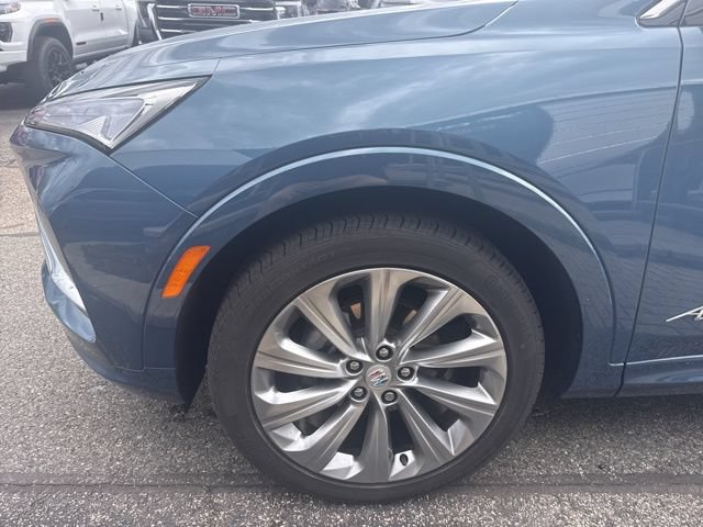 New 2025 Buick Envista Sport Touring FWD image 4