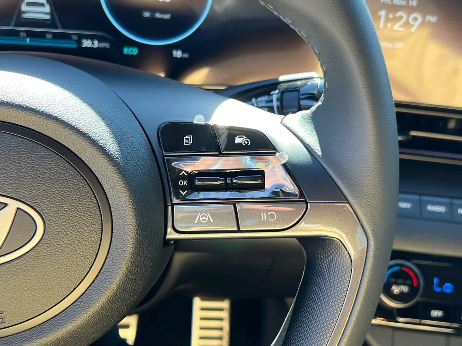 New 2026 Hyundai Elantra Sport image 17