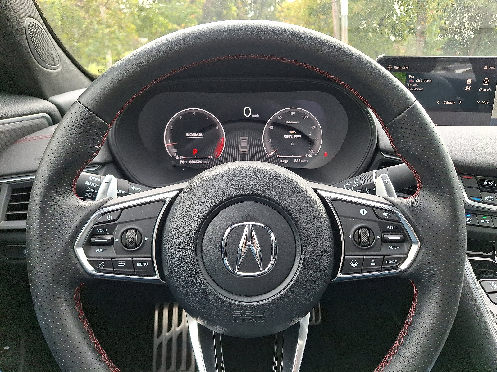 Certified 2025 Acura TLX SH-AWD w/ A-SPEC Pkg image 19