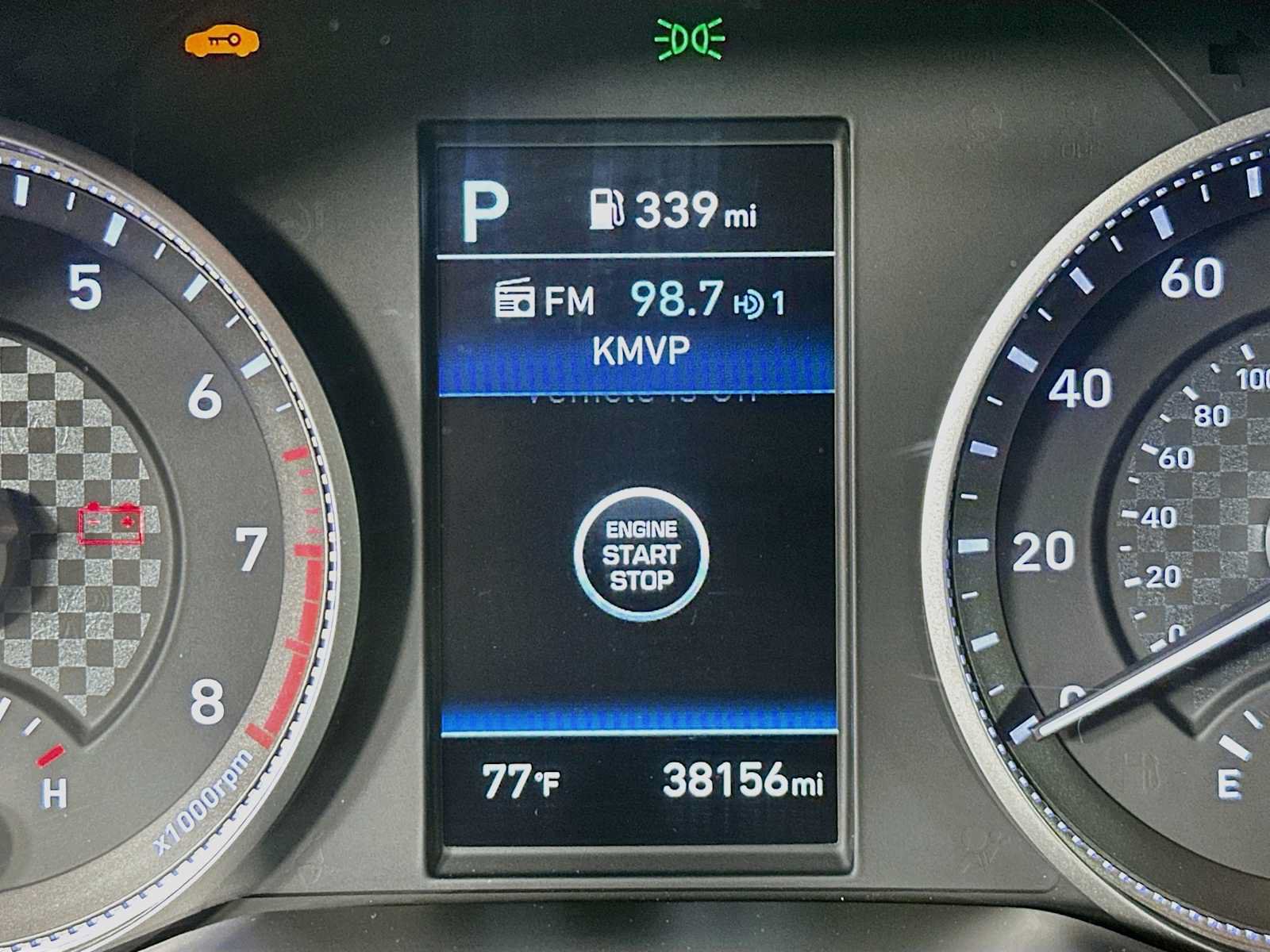 Used 2020 Hyundai Elantra Limited w/ Ultimate Package 03 FWD image 12