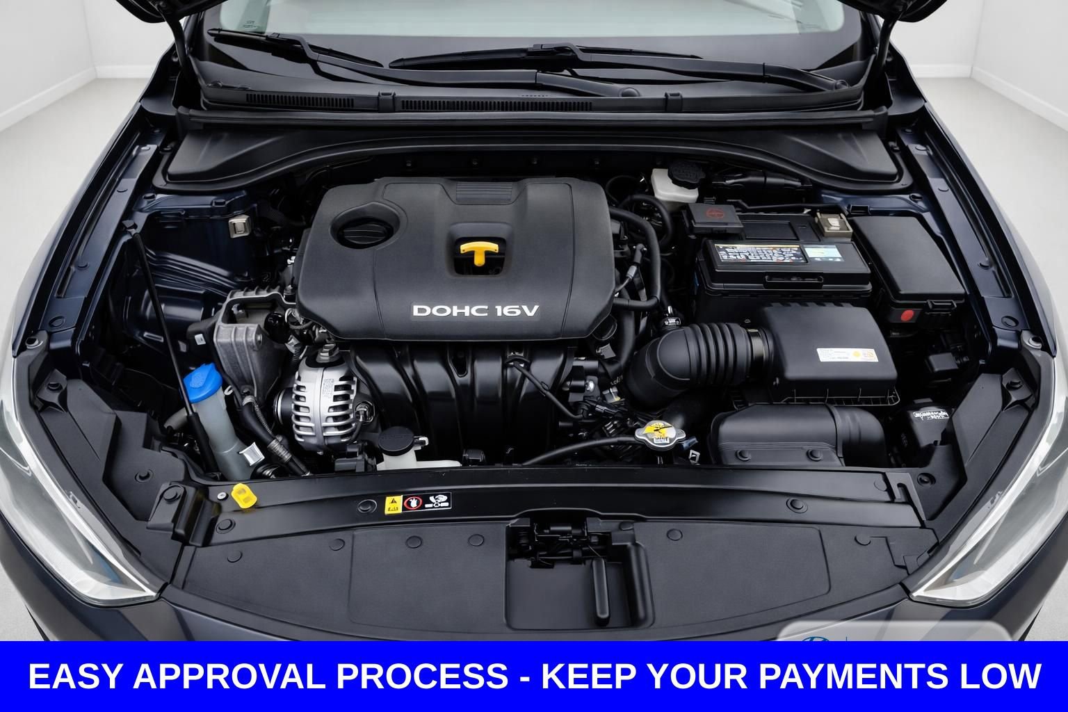 Used 2018 Hyundai Elantra SE FWD image 14
