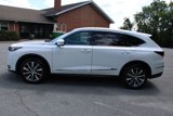New 2026 Acura MDX w/ Technology Package image 5