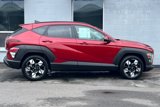 Certified 2024 Hyundai Kona SEL image 3