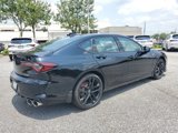New 2025 Acura TLX Type S image 5