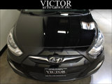 Used 2013 Hyundai Accent SE image 3