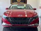 Used 2022 Hyundai Elantra Limited image 2