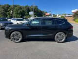 New 2026 Acura MDX w/ Advance Package image 2