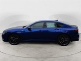 New 2025 Acura TLX SH-AWD w/ A-SPEC Pkg image 2
