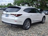 New 2025 Acura MDX SH-AWD image 5