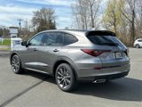 New 2025 Acura MDX A-Spec image 2