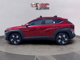 New 2025 Hyundai Kona SEL image 2