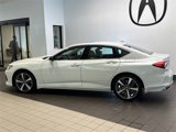 Used 2025 Acura TLX w/ Technology Package image 4