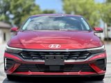 Used 2024 Hyundai Elantra Limited image 2