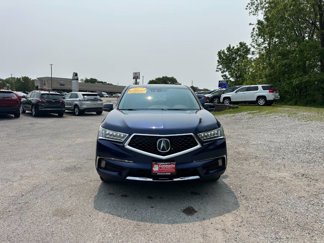 Used 2017 Acura MDX SH-AWD w/ Technology Package image 1
